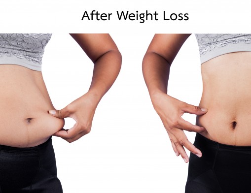 BA Med Spa can help you achieve your weight loss goals in 2016.