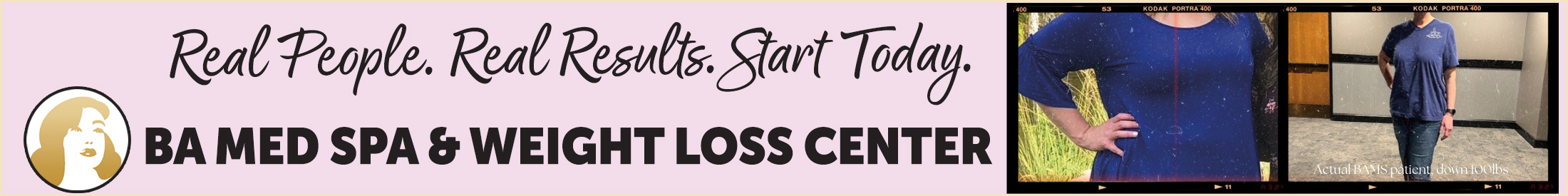Image of BA Med Spa Advertisement